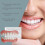 Interdental-Zahnprothesen-Korrektur-Set 4