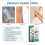 Eczema Psoriasis Treatment Spray, Itchy Redness Relief 10
