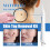 Doppelspitzen-Keratin-Stift-Set für Hautklumpen 13
