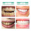 Nicotinamide Whitening Toothpaste - Tartar Control, Fresh Breath 15