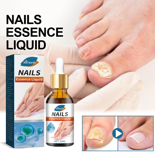 Nails Essence Liquid Thickening Repairing Soft Armor 1