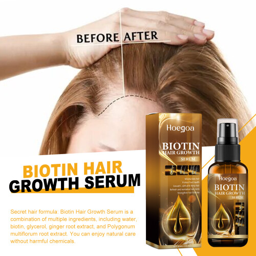 Biotin-Haarwuchsserum, pflegt starkes Haar 2