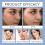 Collagen Moisturizing Mask: Gentle Hydrating & Refreshing 13