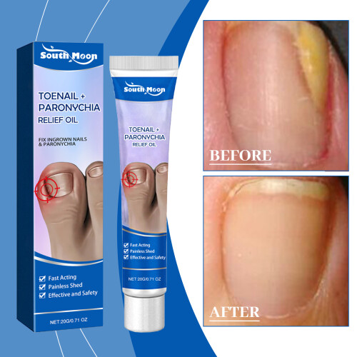 Nail Care Ointment for Moisturizing Nails 1