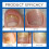 Nail Care Ointment for Moisturizing Nails 15