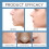 Acne Care Pen: Gently Cleans & Closes Acne 15