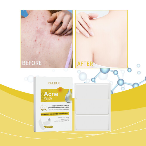 Back & Shoulder Acne Patch Clean Repair Breathable 1