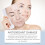 Invisible Acne Patch Mild Clear Repair 14
