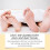 Bee Venom Foot Spray Relieves Swelling, Peeling & Cracking Feet 3