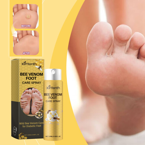 Bee Venom Foot Spray Relieves Swelling, Peeling & Cracking Feet 1