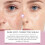 Patch Repair Cream 3