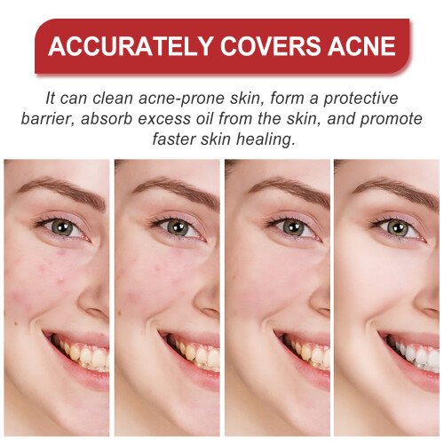 Facial Acne Patch, Gentle Skin Smoothing Multi-Shape 2
