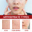 Facial Acne Patch, Gentle Skin Smoothing Multi-Shape 4