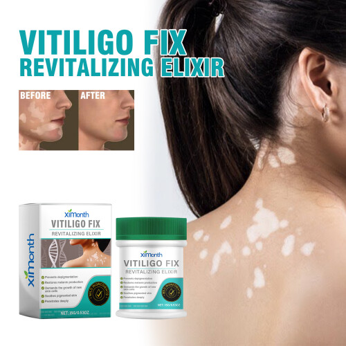 Vitiligo Fix Elixir for Skin Spots & Even Tone 1
