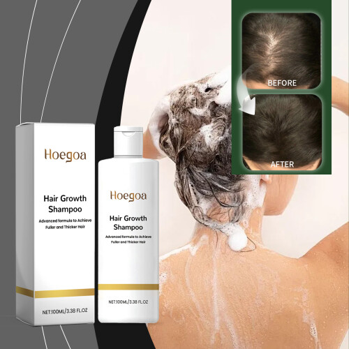 Reis-Shampoo für Kopfhautpflege 1