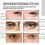 Augen-Essenz: Reduziert Falten & Augenringe, strahlt auf 14