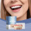 Zahnspangen-Sets für Kosmetik: Angenehmes Material 8