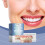 Zahnspangen-Sets für Kosmetik: Angenehmes Material 2