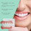 Denture Cosmetic Braces: Enhance Smile, Comfortable Material 3
