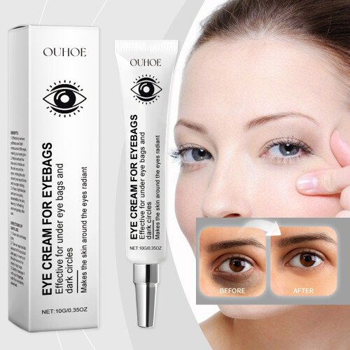 Augencreme gegen Schwellungen & dunkle Ringe 1