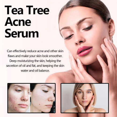 Tea Tree Acne Serum, Anti-Wrinkle Moisturizing Brightening 1