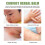 Comfrey Herbal Balm: Anti-Itch Cream for Mosquito Bites 3