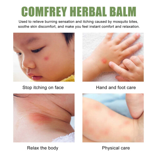 Comfrey Herbal Balm: Anti-Itch Cream for Mosquito Bites 2