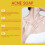 Acne Cleansing Soap for Back Pimples 13