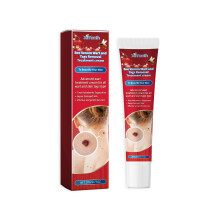 Bee Venom Wart Care Cream, Skin Smoothing & Lightening