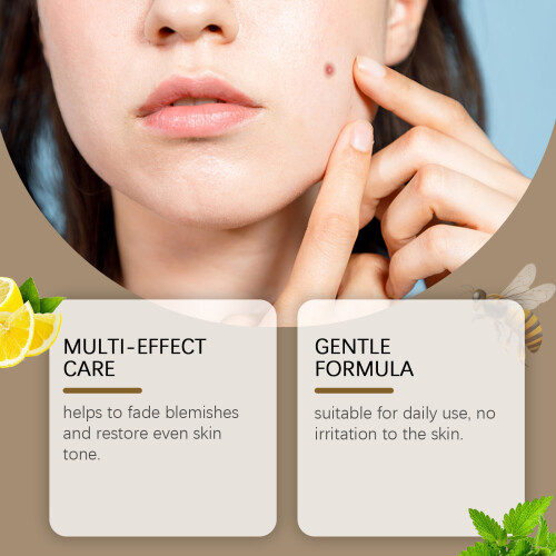 Bee Venom Mole Removal Cream - Cleansing, Moisturizing, Soothes 2