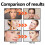 Retinol Serum Anti-Wrinkle Smooth Fine Lines 15