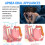 Sleep Breathing Orthodontic Braces - Night Correction, Anti-Snoring 14