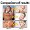 Summer UV Moisturizer: Light, Non-Greasy, Breathable 14