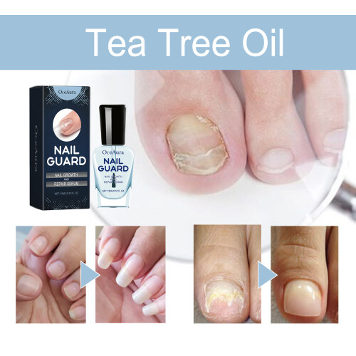 Nail Care Solution: Gently Cleanses & Nourishes Nails 2
