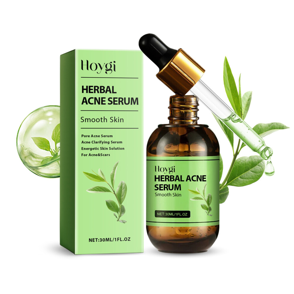 Herbal Acne Serum: Reduce Pimples & Hydrate