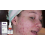 Niacinamid Anti-Akne Serum Feuchtigkeitsaufhellend 7
