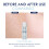 Serum for Pore Size: Moisturizing, Reducing Dark Spots, Whitening 13