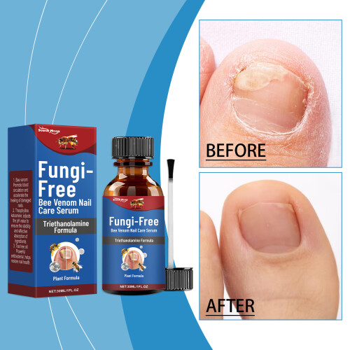 Bee Venom Nail Solution: Gentle Cleansing & Repair 1