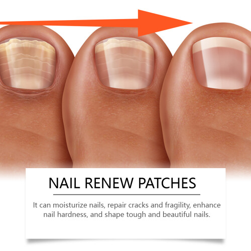 Nail Repair Patch for Moisturizing & Smooth Nails 2