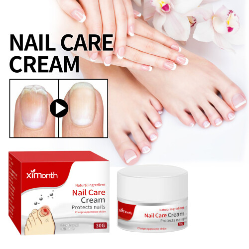 Nagelpflegecreme bei eingewachsenen Nägeln 1
