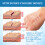 Closed Wound Care Patch - Gentle Skin Comfort 13