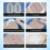 Closed Wound Care Patch - Gentle Skin Comfort 6