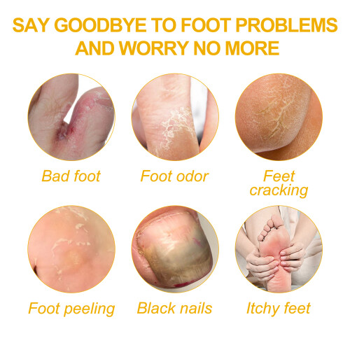 Nail Repair Liquid Thickening Softening 2