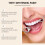 Brightening Tooth Stain Remover 11