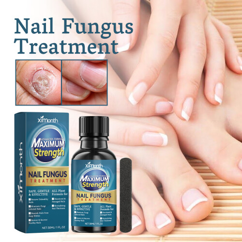 Brüder Nagelpilzbehandlung 1
