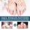Brüder Nagelpilzbehandlung 14