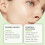 Clear Anti-Acne Patch 12