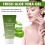 Aloe-Vera-Gel - Beruhigend bei Sonnenbrand 3
