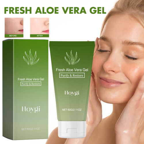 Aloe-Vera-Gel - Beruhigend bei Sonnenbrand 1