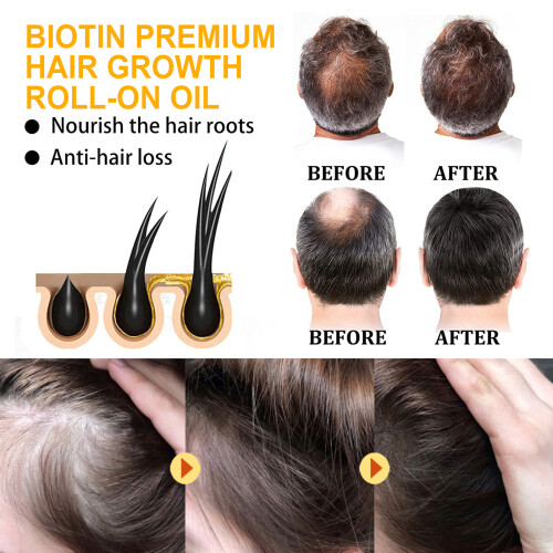 Biotin-Haarkugel für sanfte Pflege und glattes Haar 2